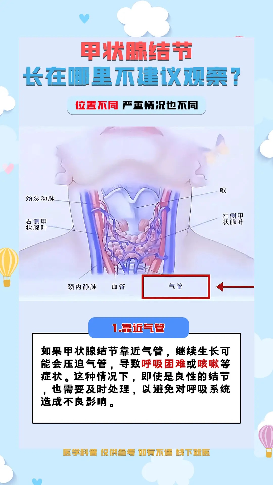 甲状腺结节应该挂什么科?