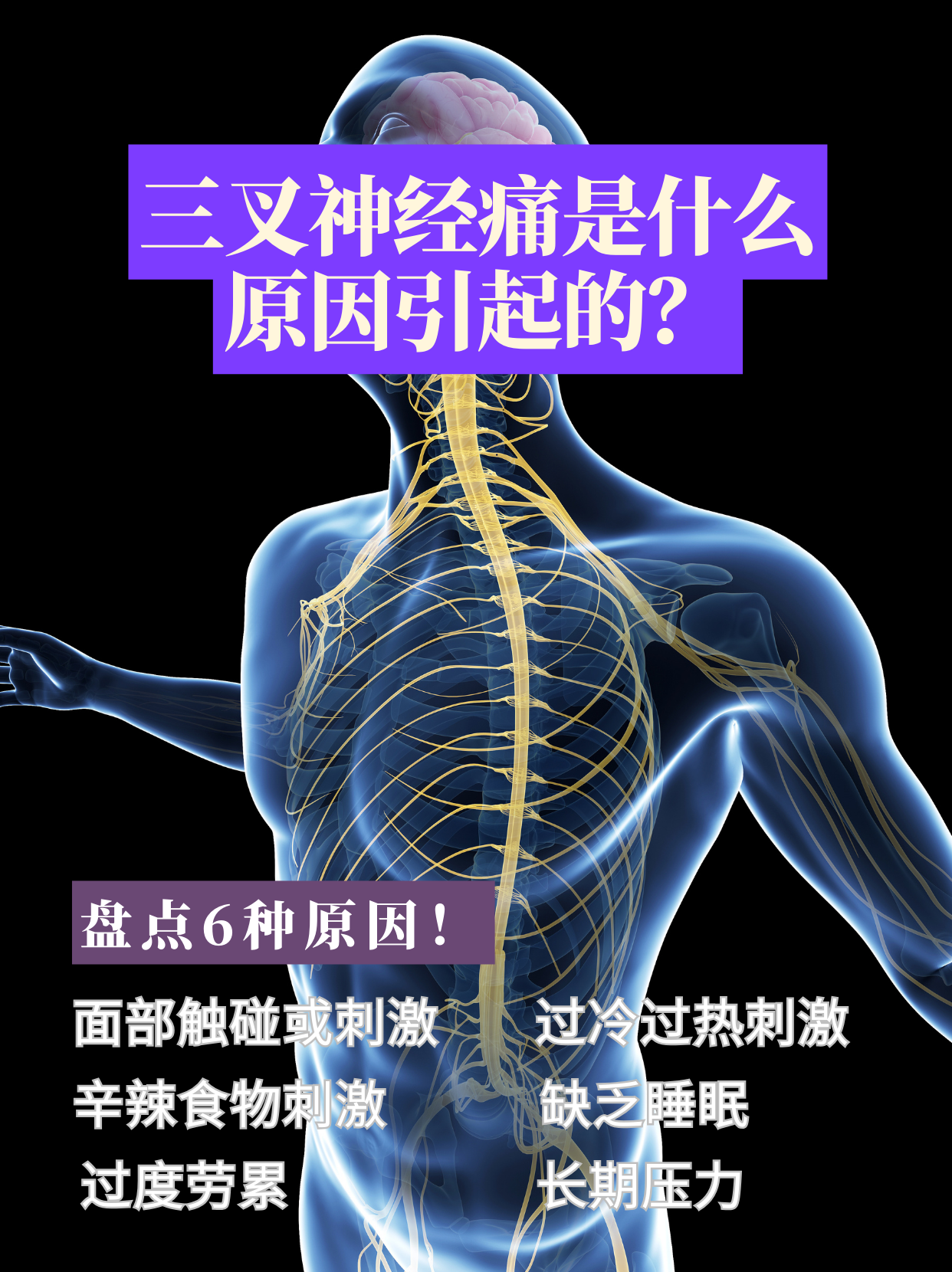 三叉神经炎是什么病