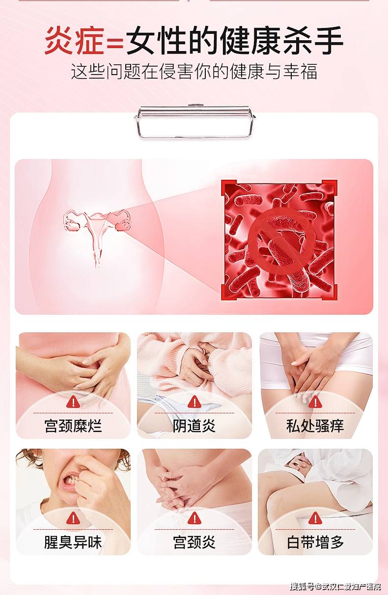 霉菌性阴道炎有哪些症状