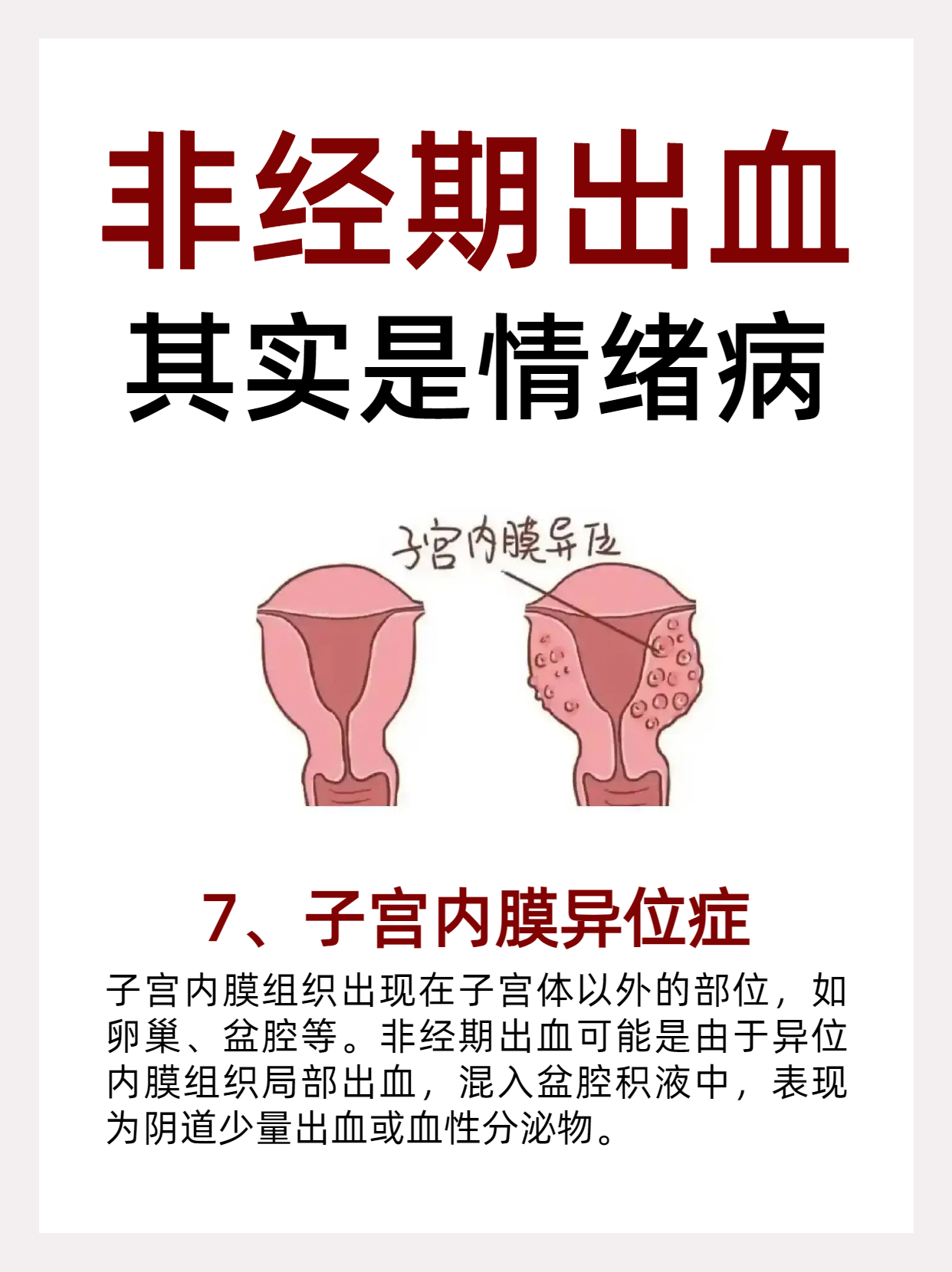 非月经期出血的原因都有哪些