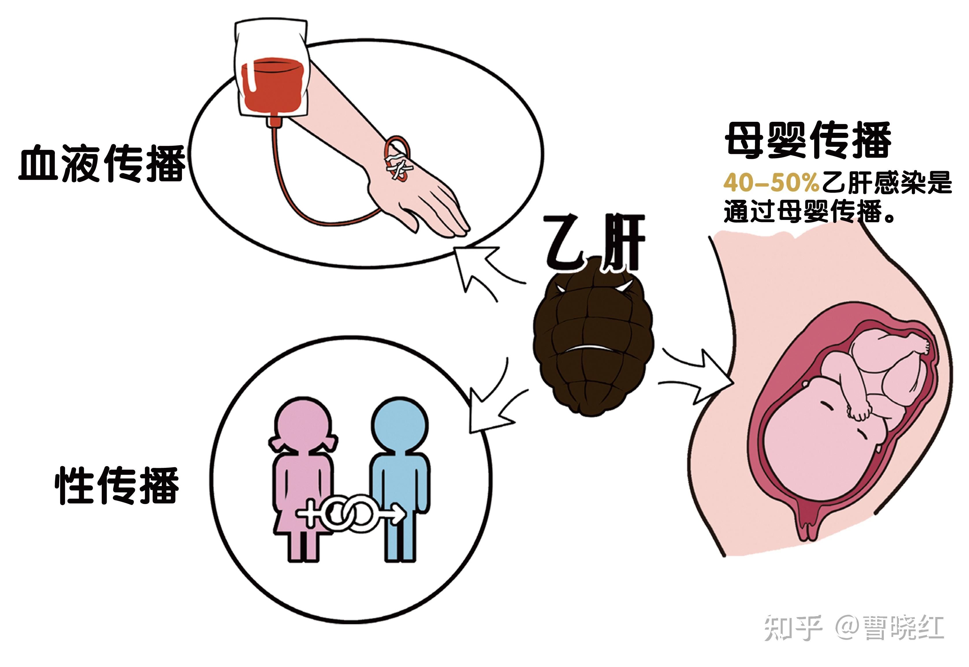乙肝病毒传播途径有哪些?