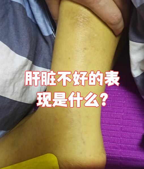 肝脏有问题的症状