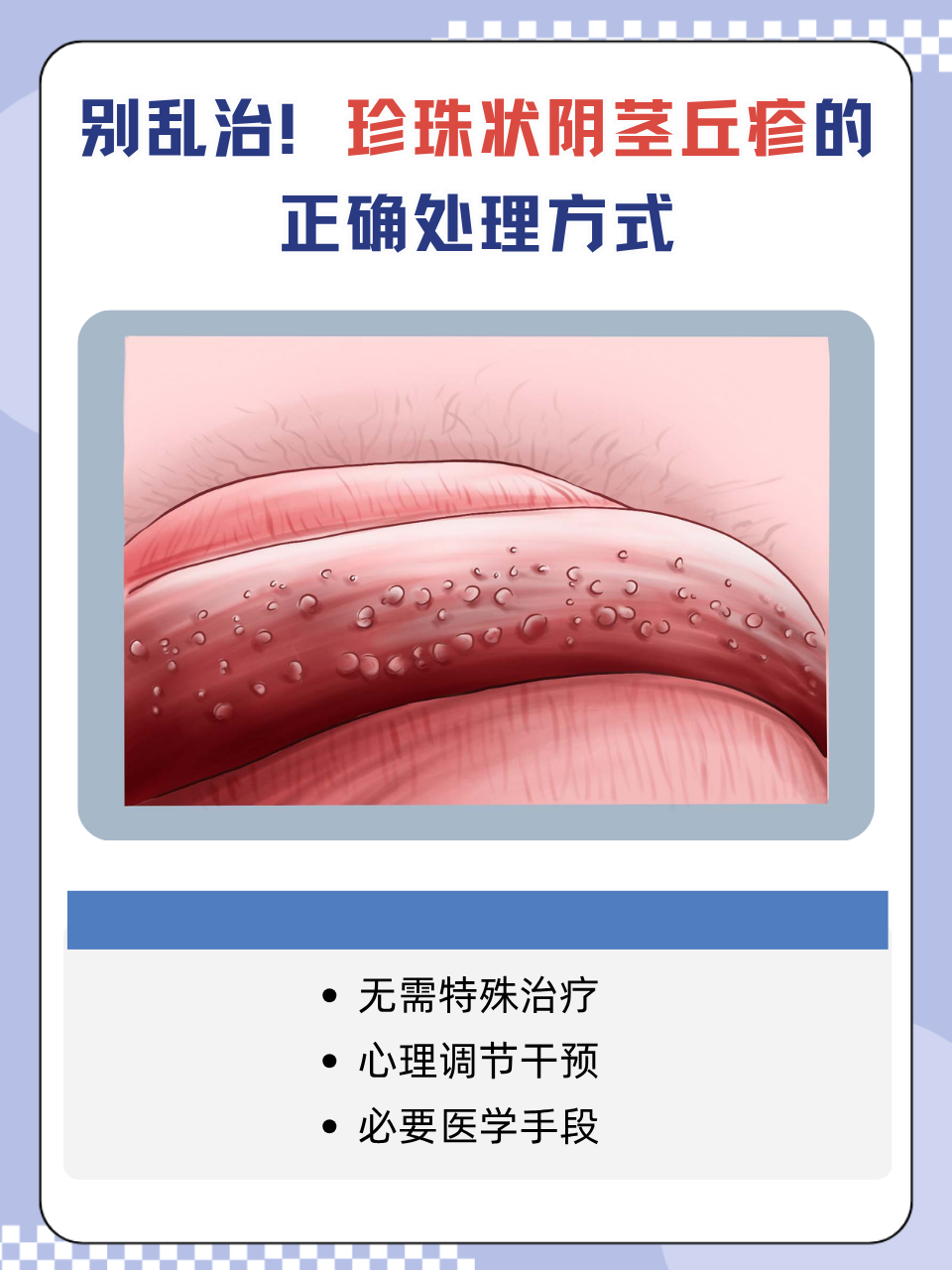 龟头上起疙瘩