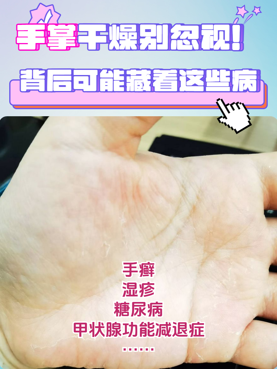 手脱皮了怎么好的快