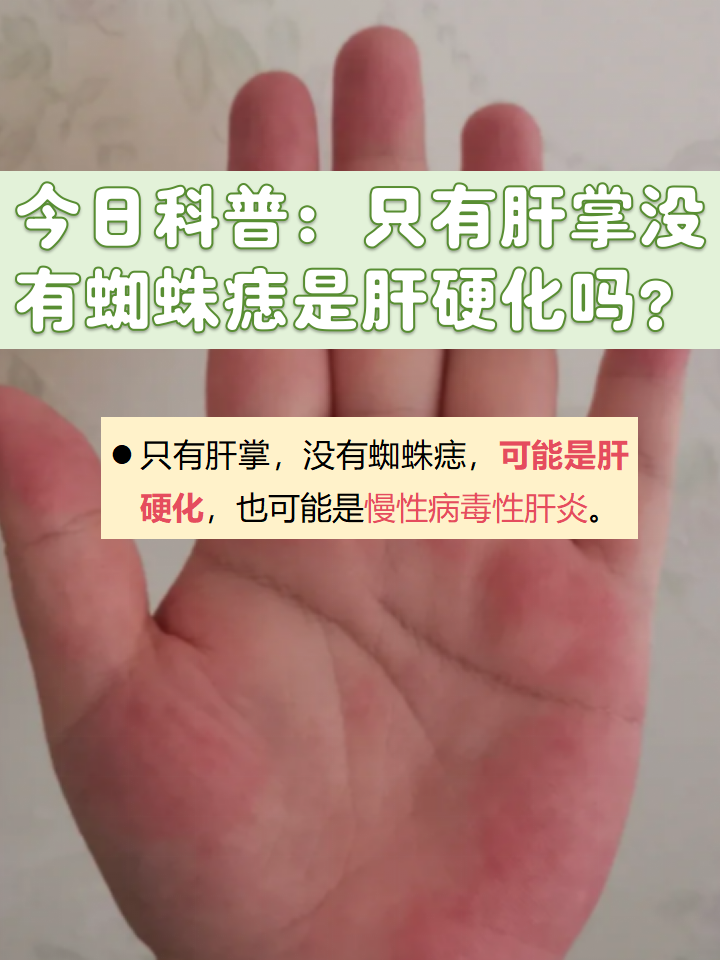 肝硬化皮肤瘙痒原因