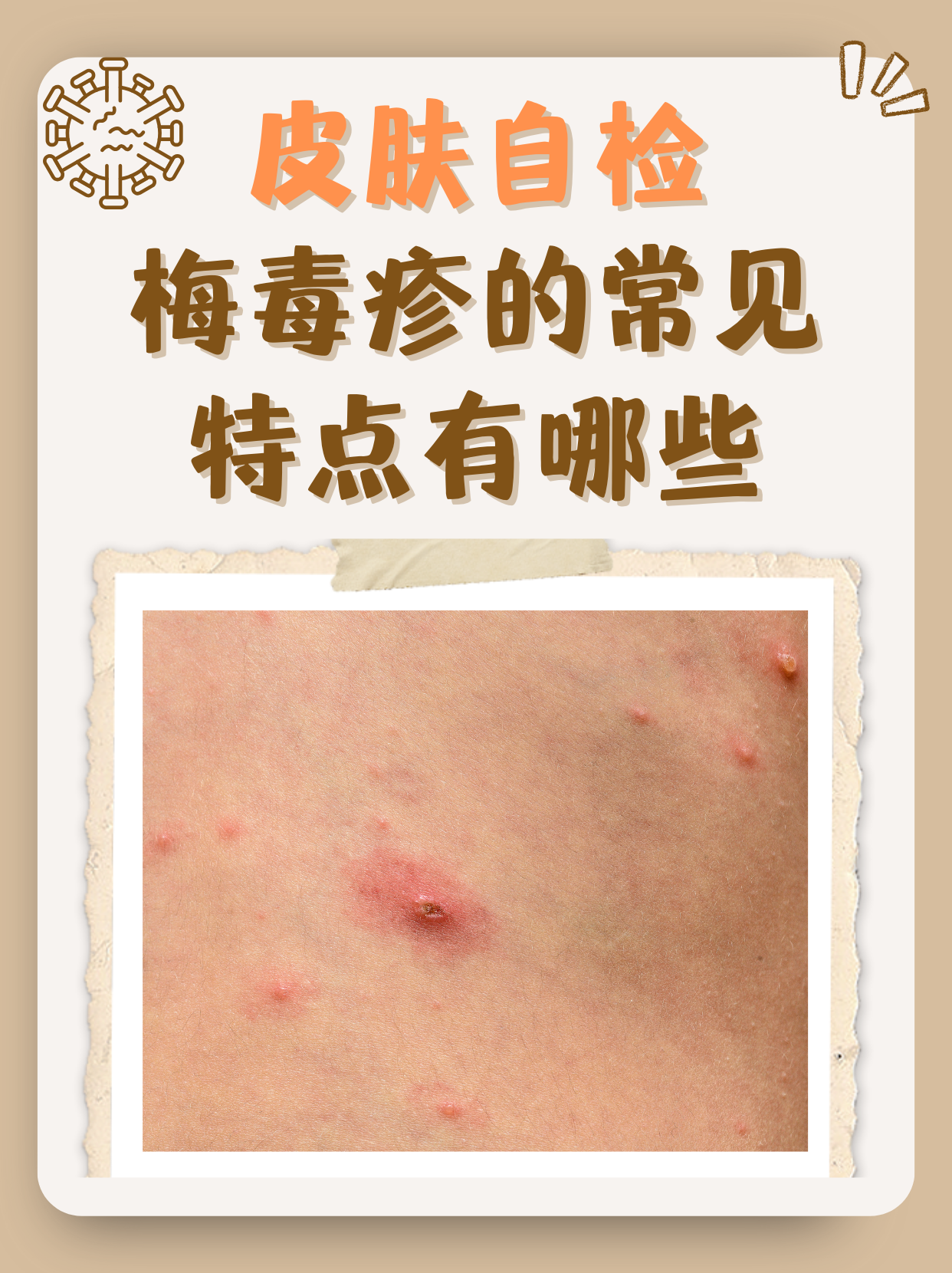 梅毒阳性会传染吗