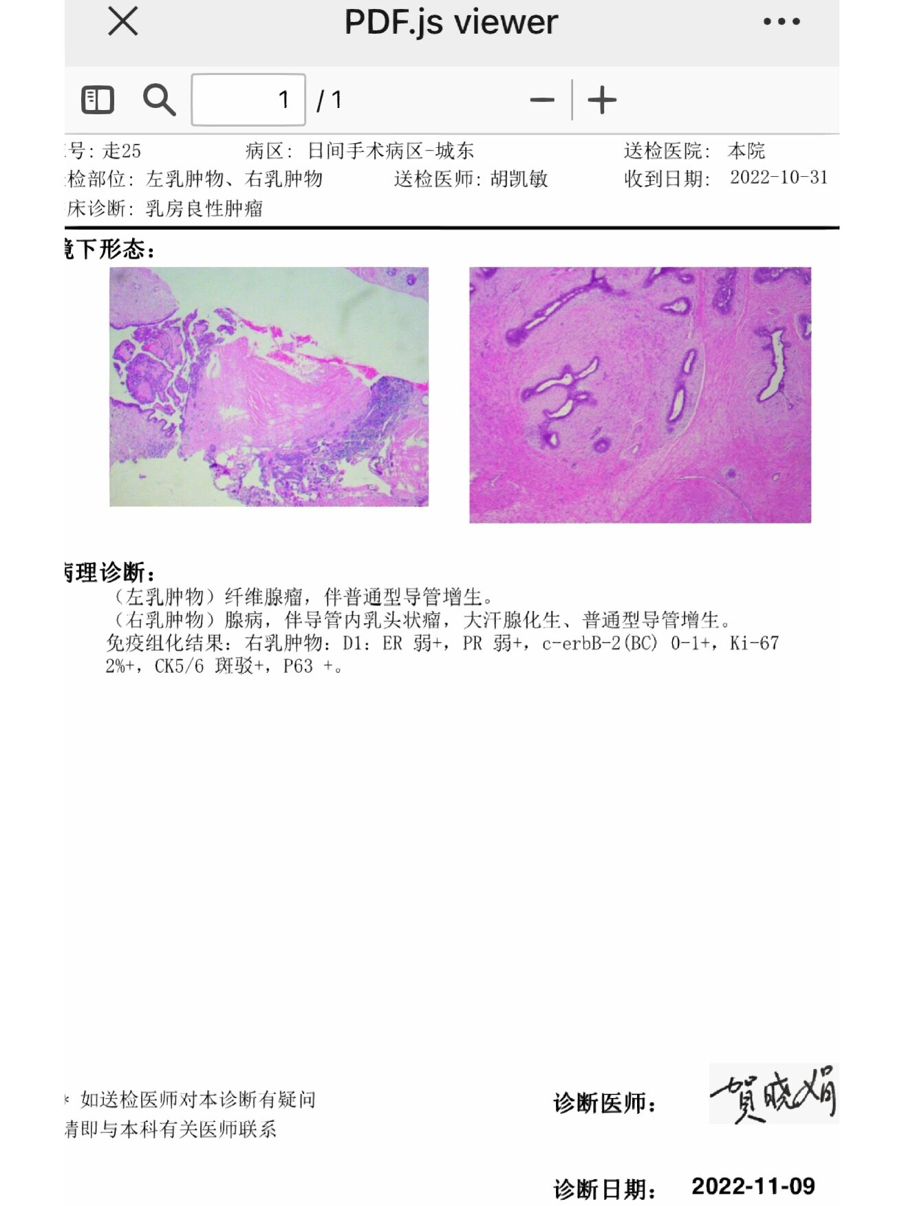 免疫组化结果怎么看?