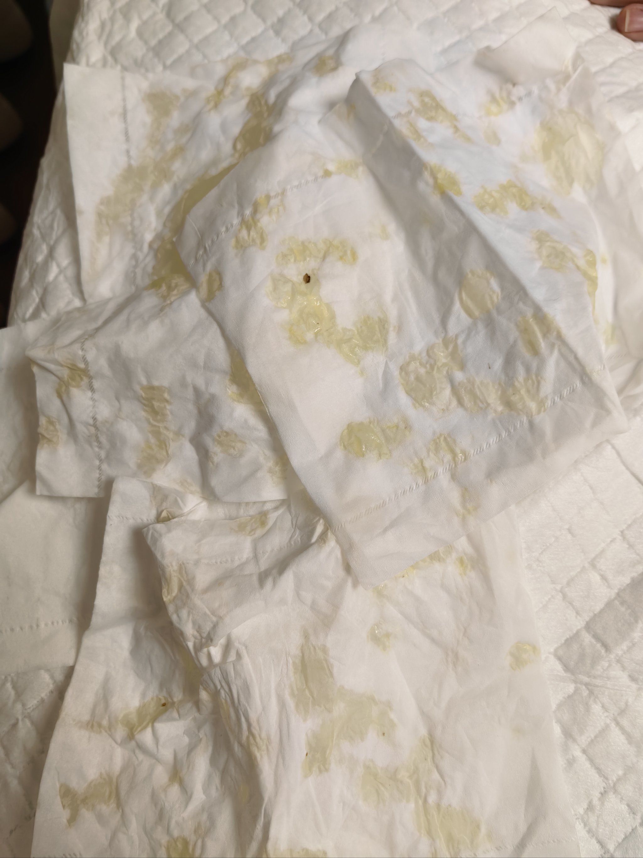 断奶后有残乳需要排出来吗?