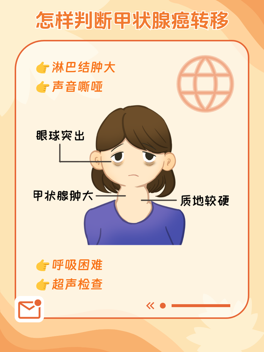 甲状腺癌转移淋巴寿命是多久?