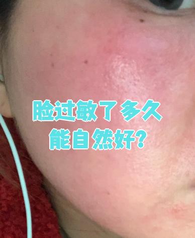 化妆品过敏的表现