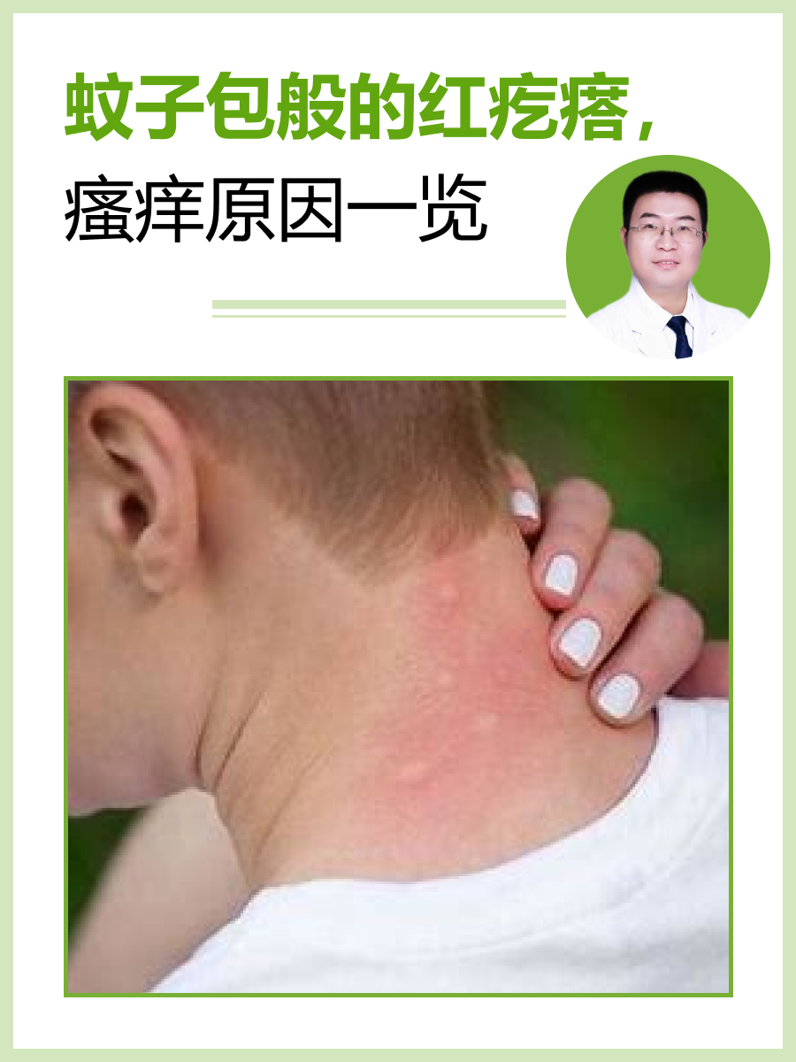 被蚊子咬了.为什么会起包