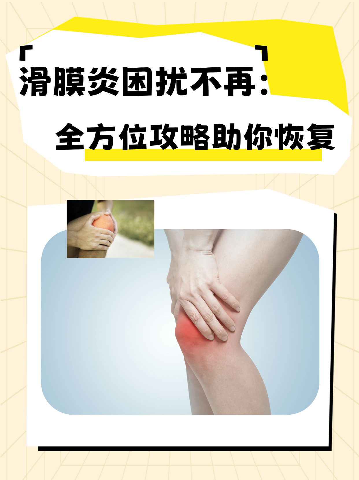 滑膜炎的治疗方法