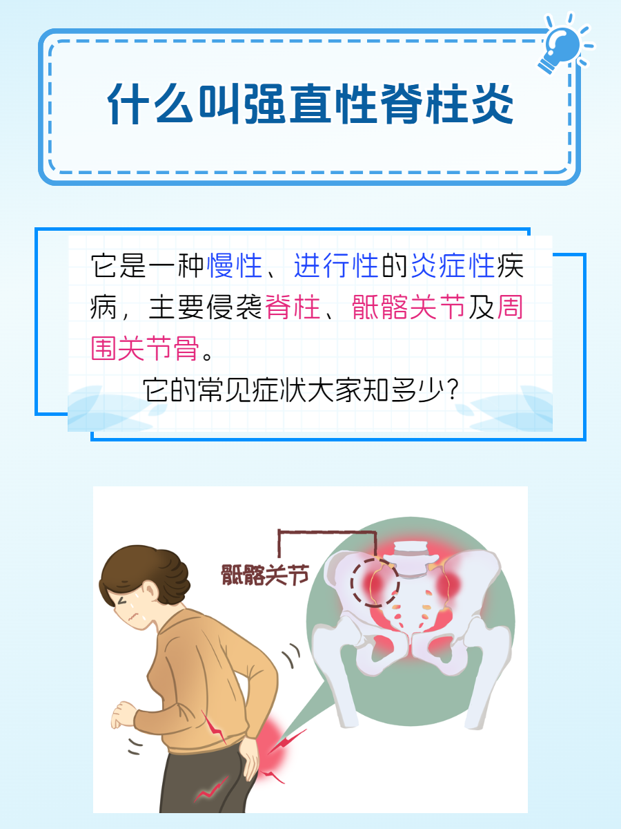 强直性脊柱炎症状表现有什么?