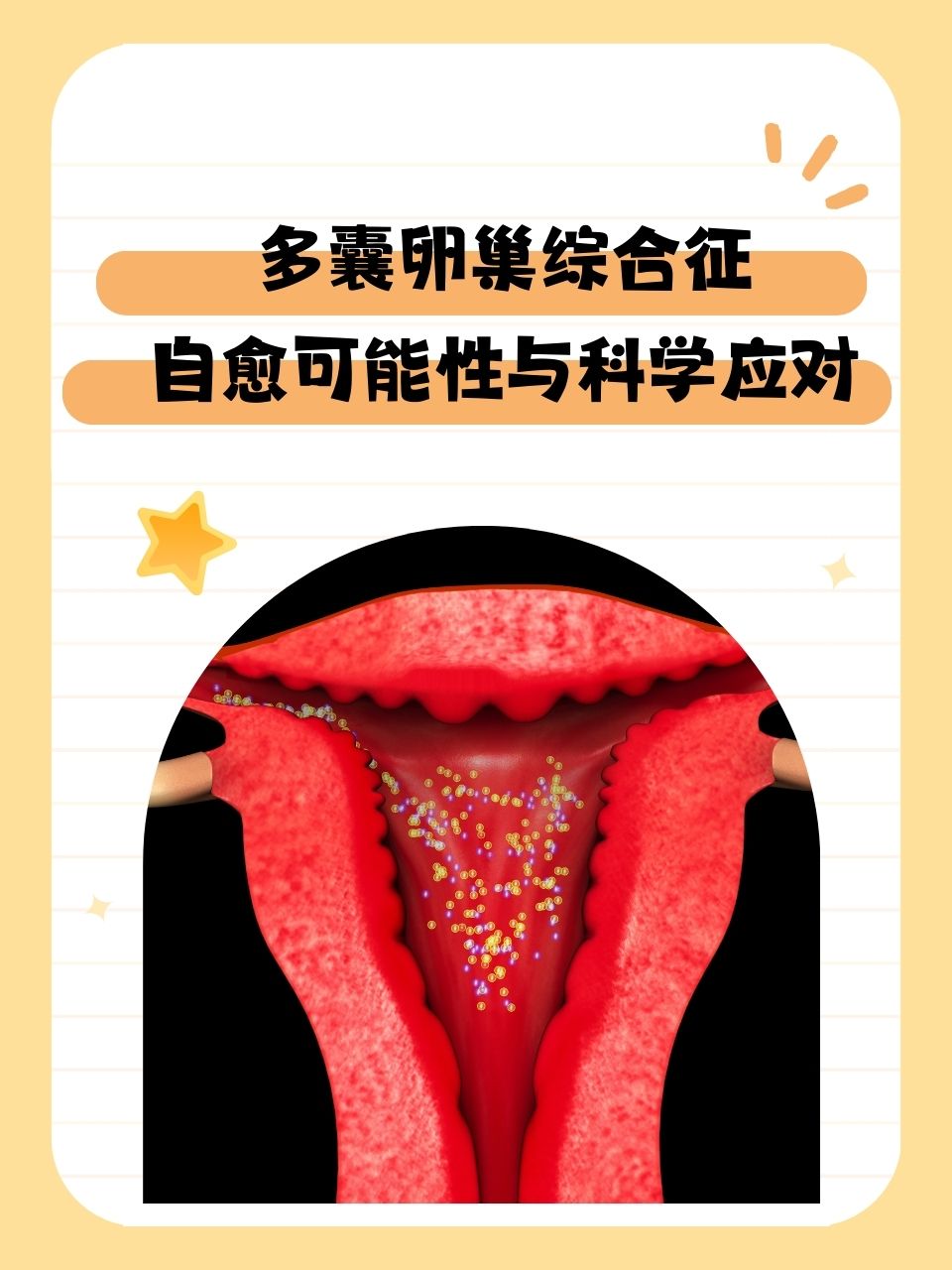 多囊卵巢综合症的症状