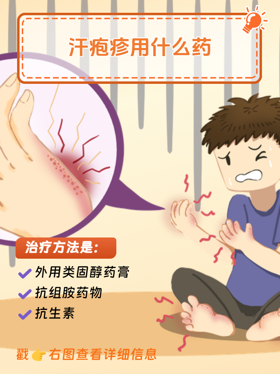 手上起汗疱疹怎么治疗