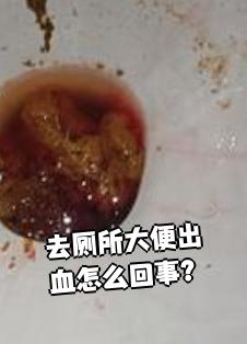 拉大便出血是怎么回事