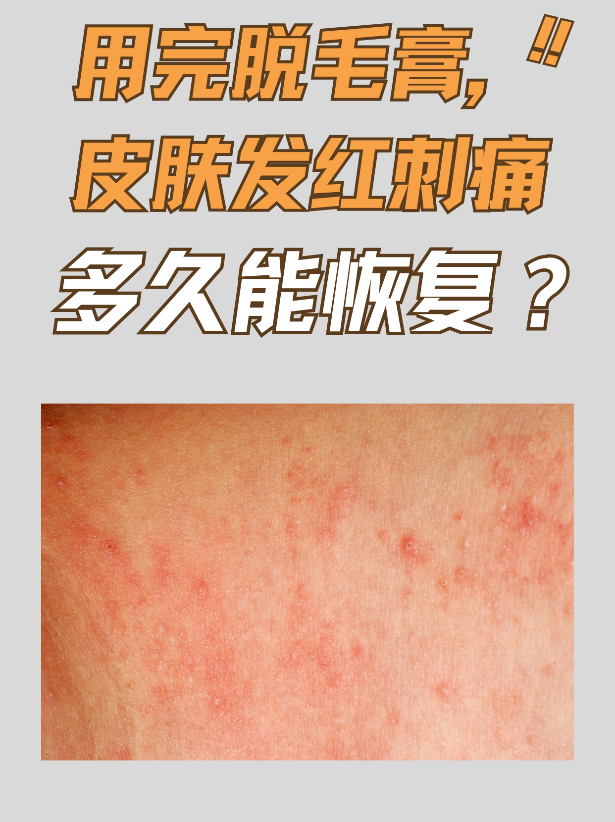 脱毛膏能维持多长时间?
