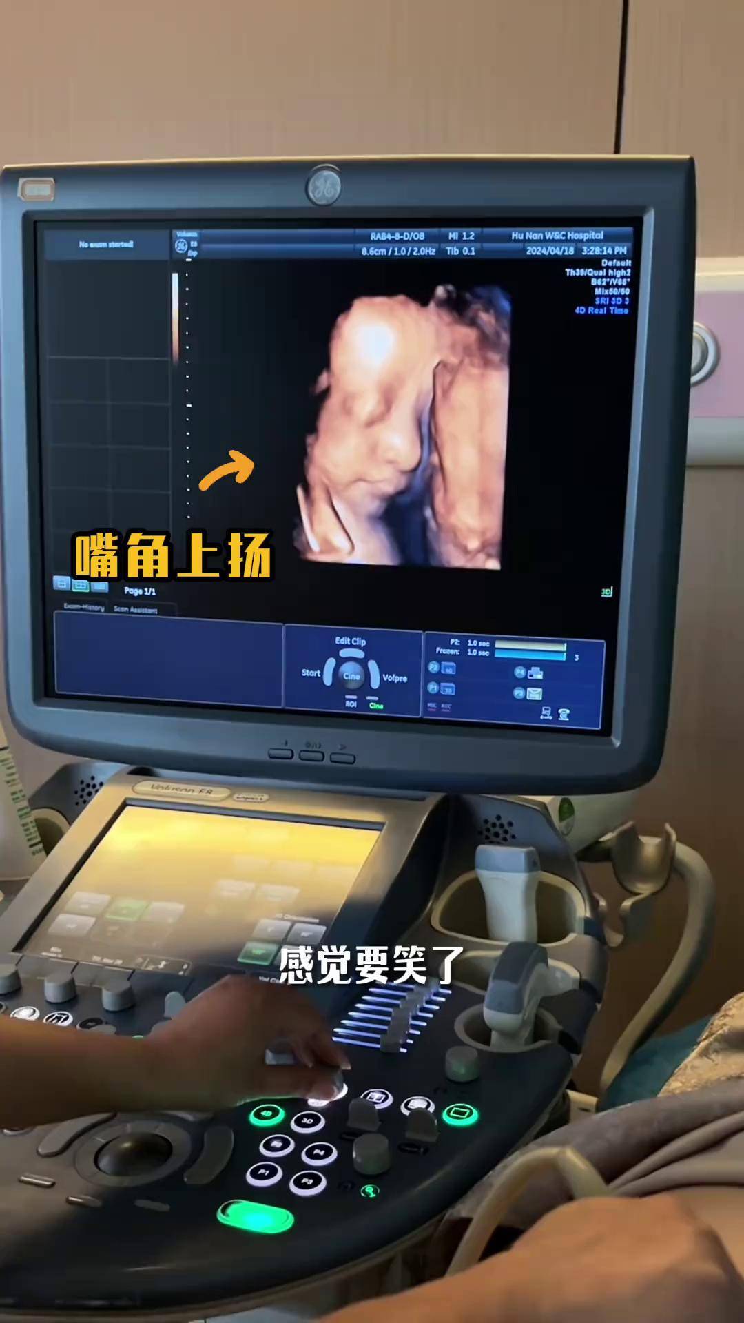 怀孕几周做四维