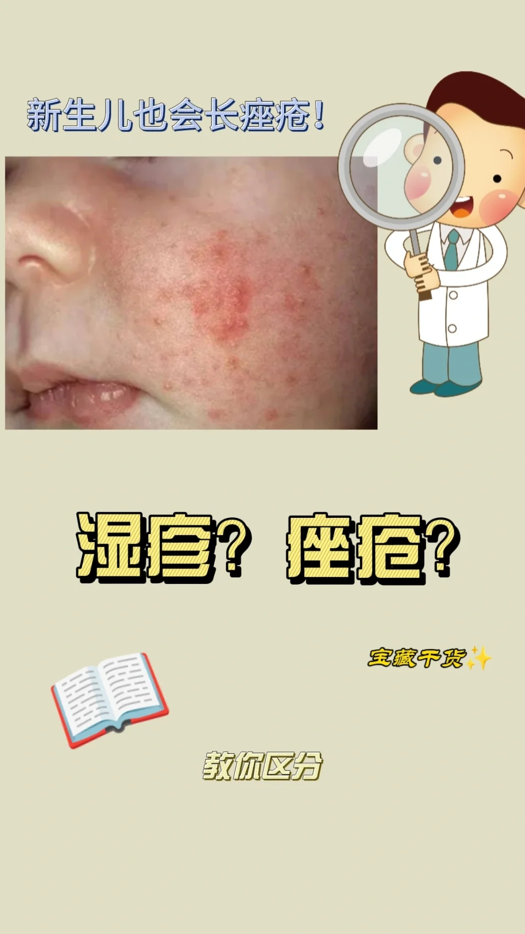 婴儿脸上有湿疹怎么办