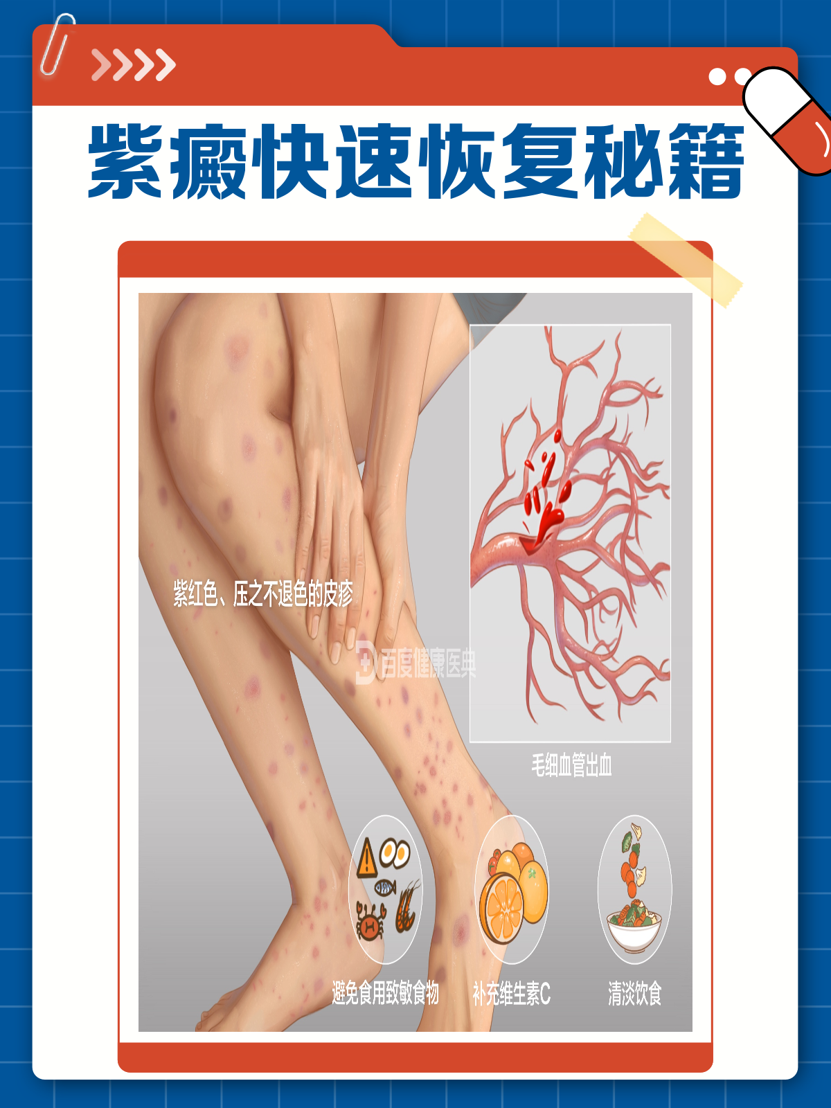 紫癜病能够治好吗?