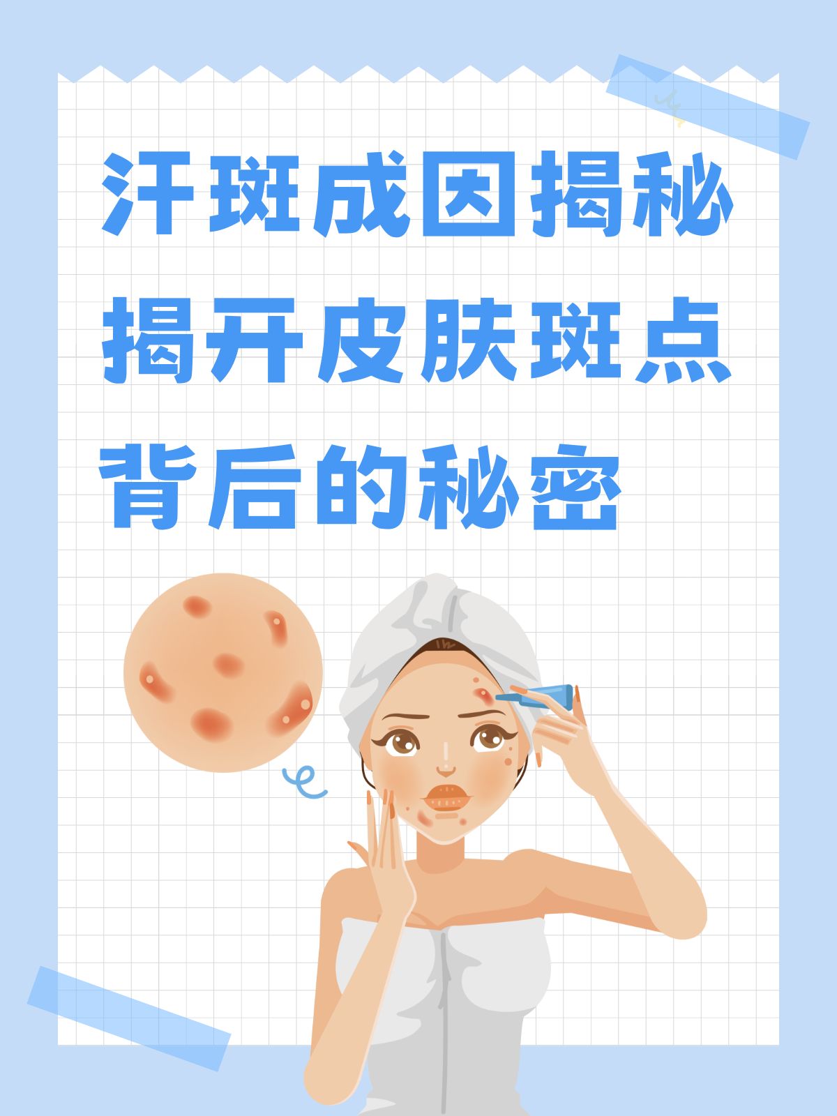 汗斑是怎么引起的呢?