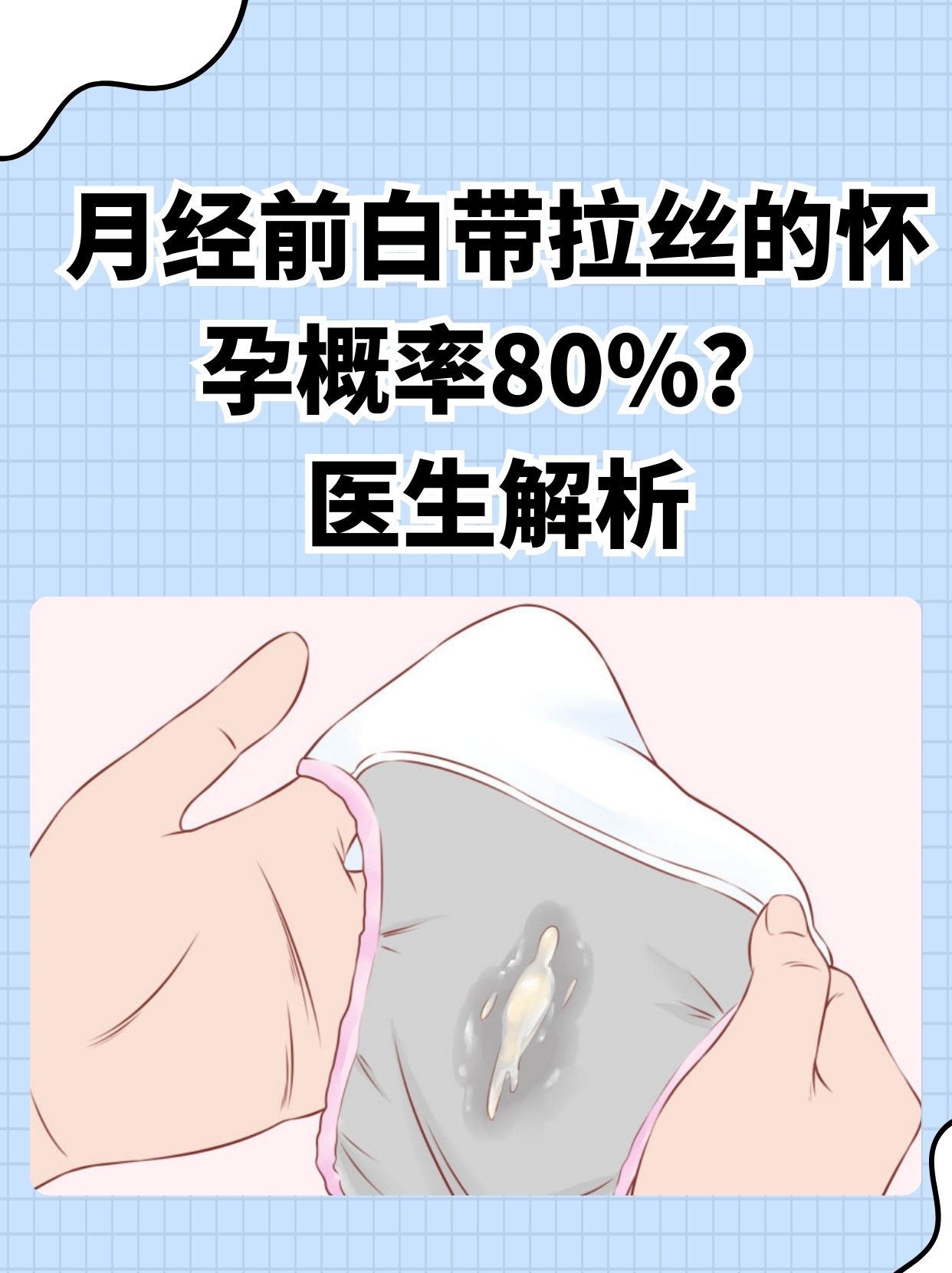 什么是白带拉丝