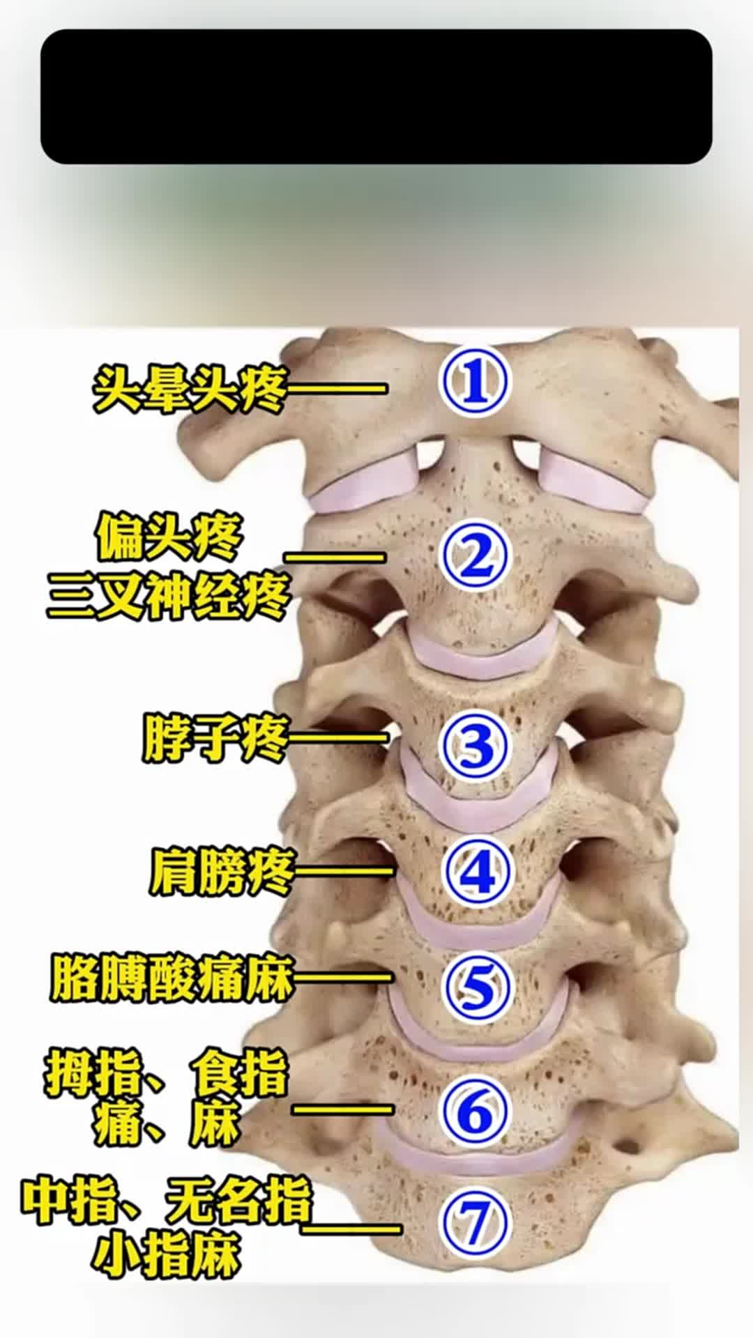颈椎病有什么症状