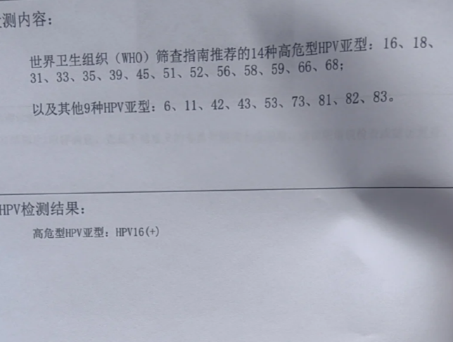 非典型鳞状上皮细胞是什么意思