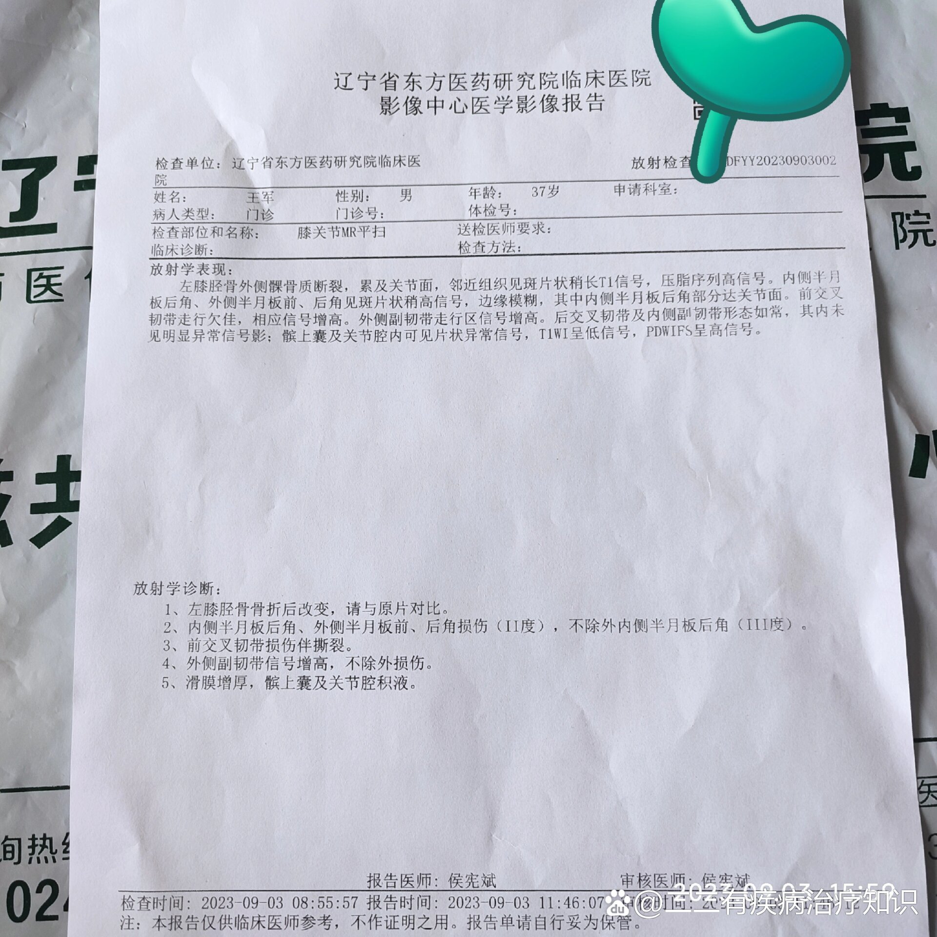 骨科拍片多少钱