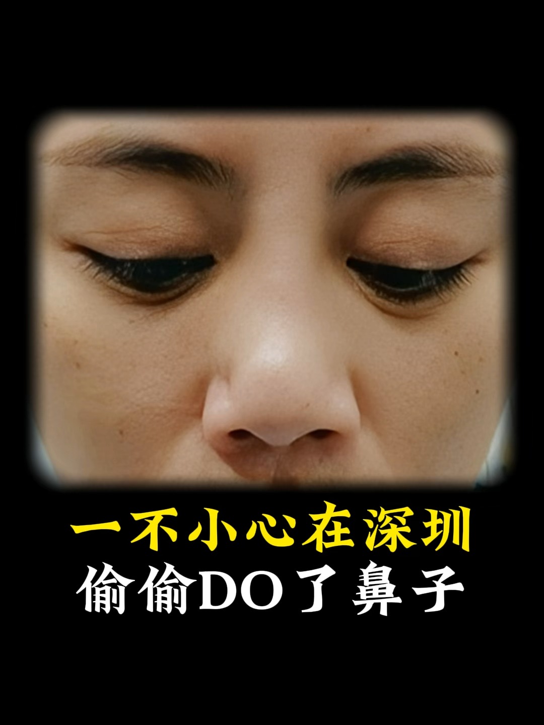 一不小心捏了一下鼻子就红了.他们说这是火气