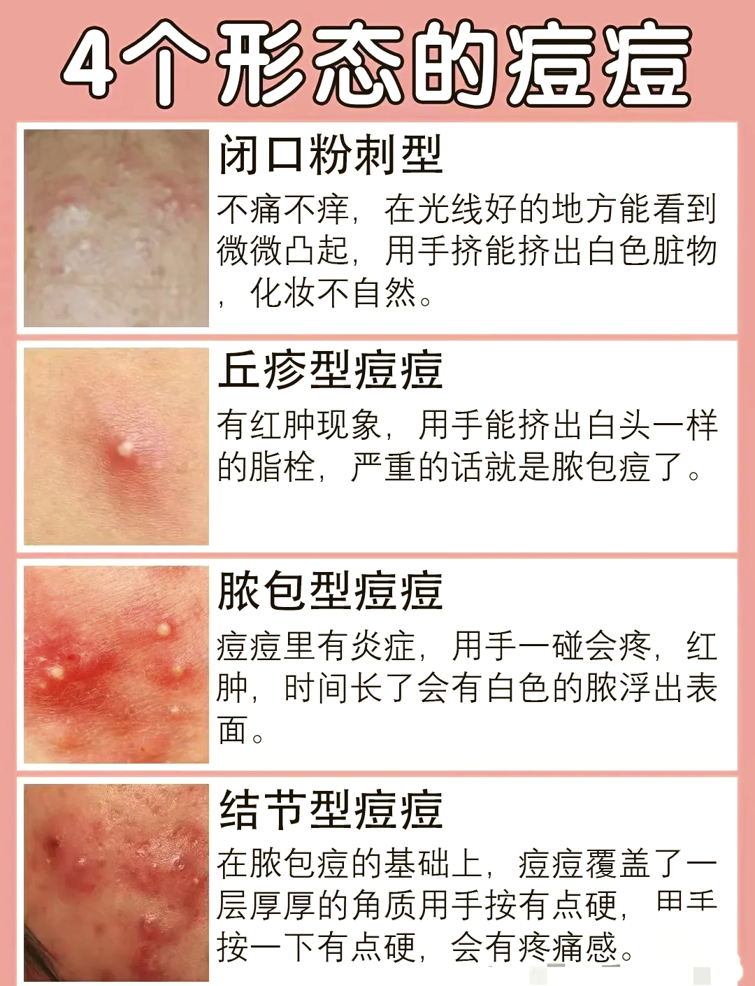 皮肤起了疙瘩,什么原因