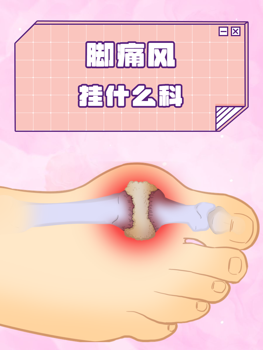 痛风脚肿怎么消肿止痛