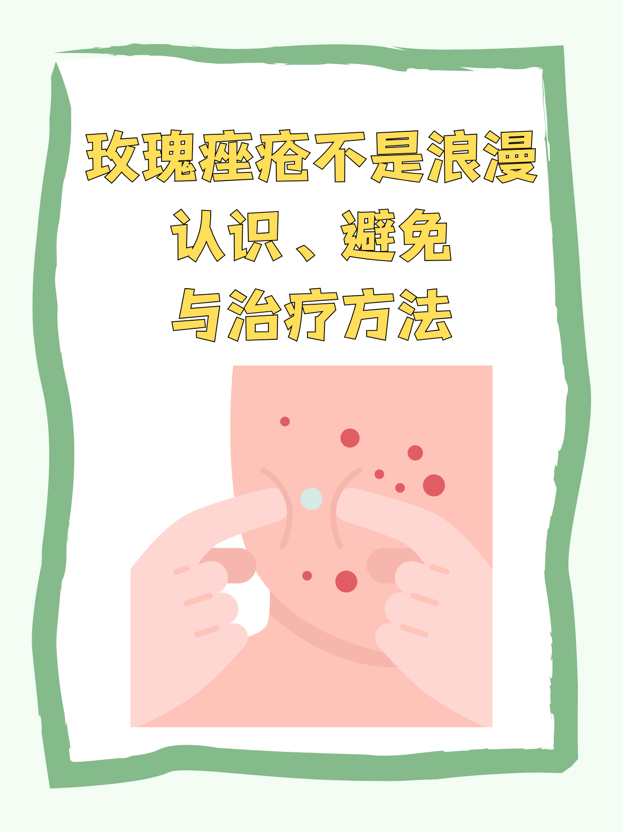 玫瑰痤疮的治疗方法