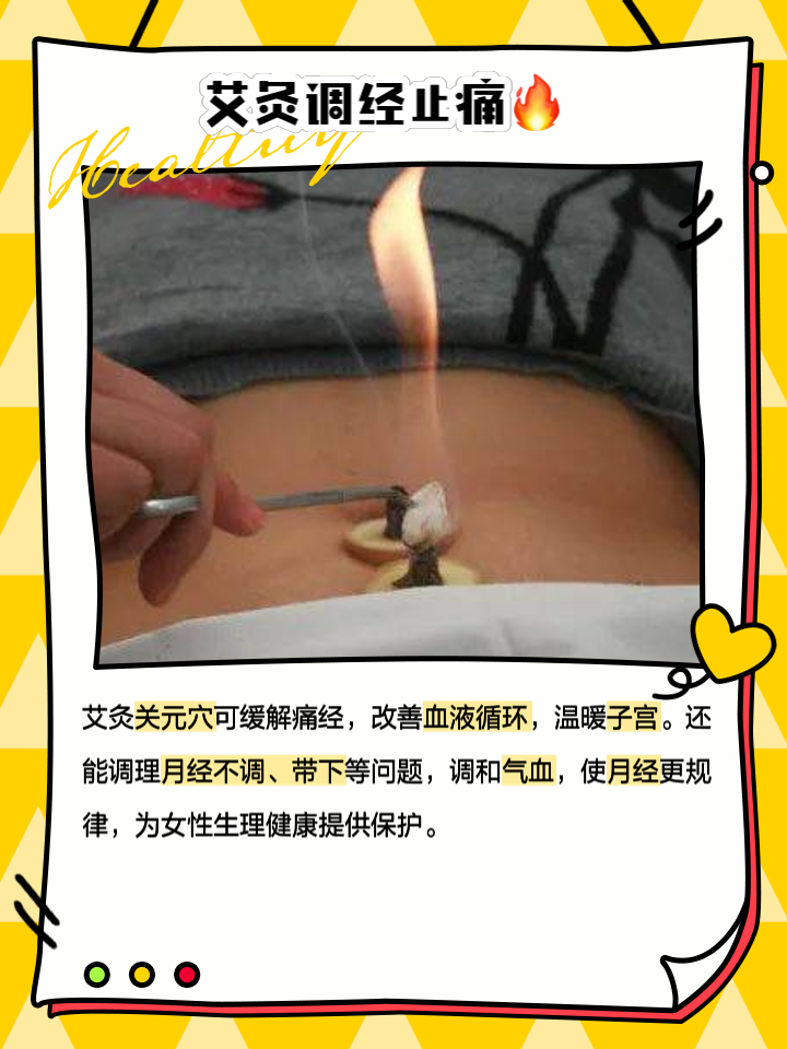 月经期间可以艾灸吗