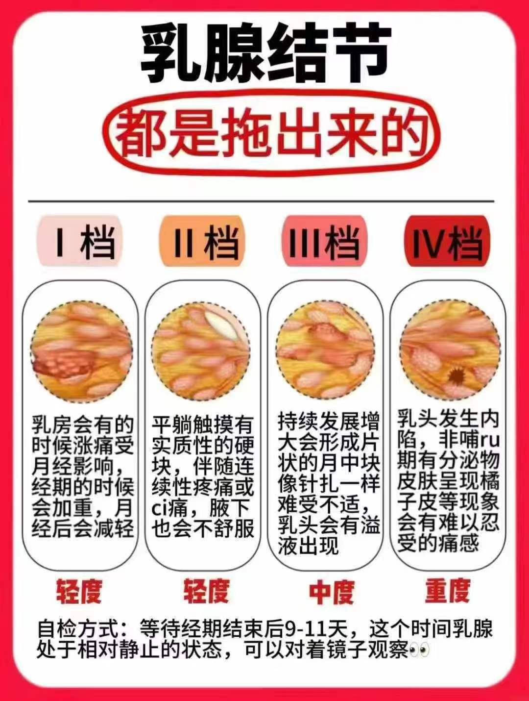 乳腺增生挂什么科室?