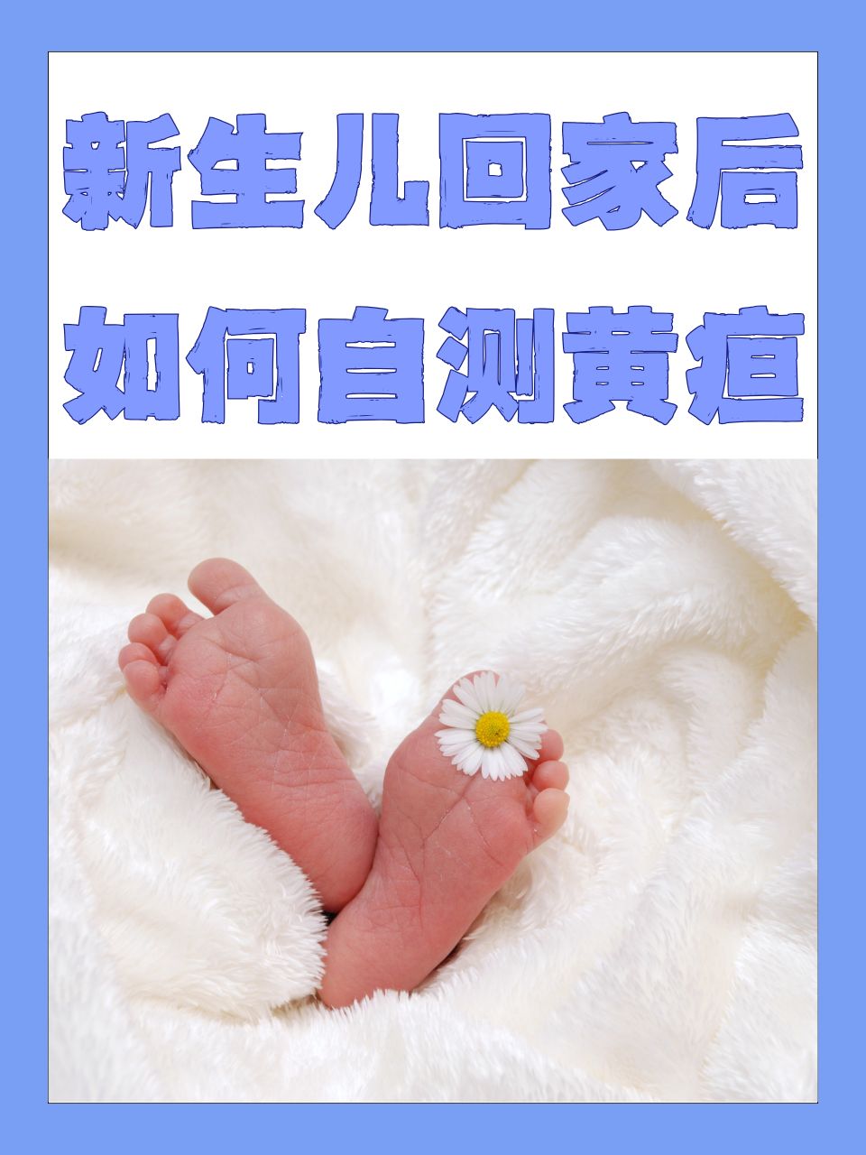 新生儿黄疸症状有什么