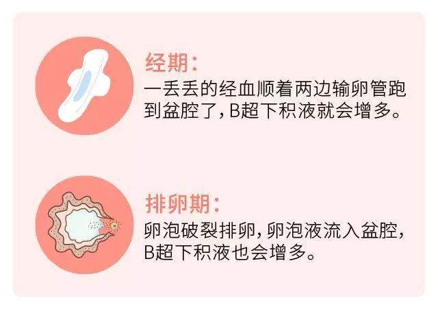 盆腔积液影响月经推迟