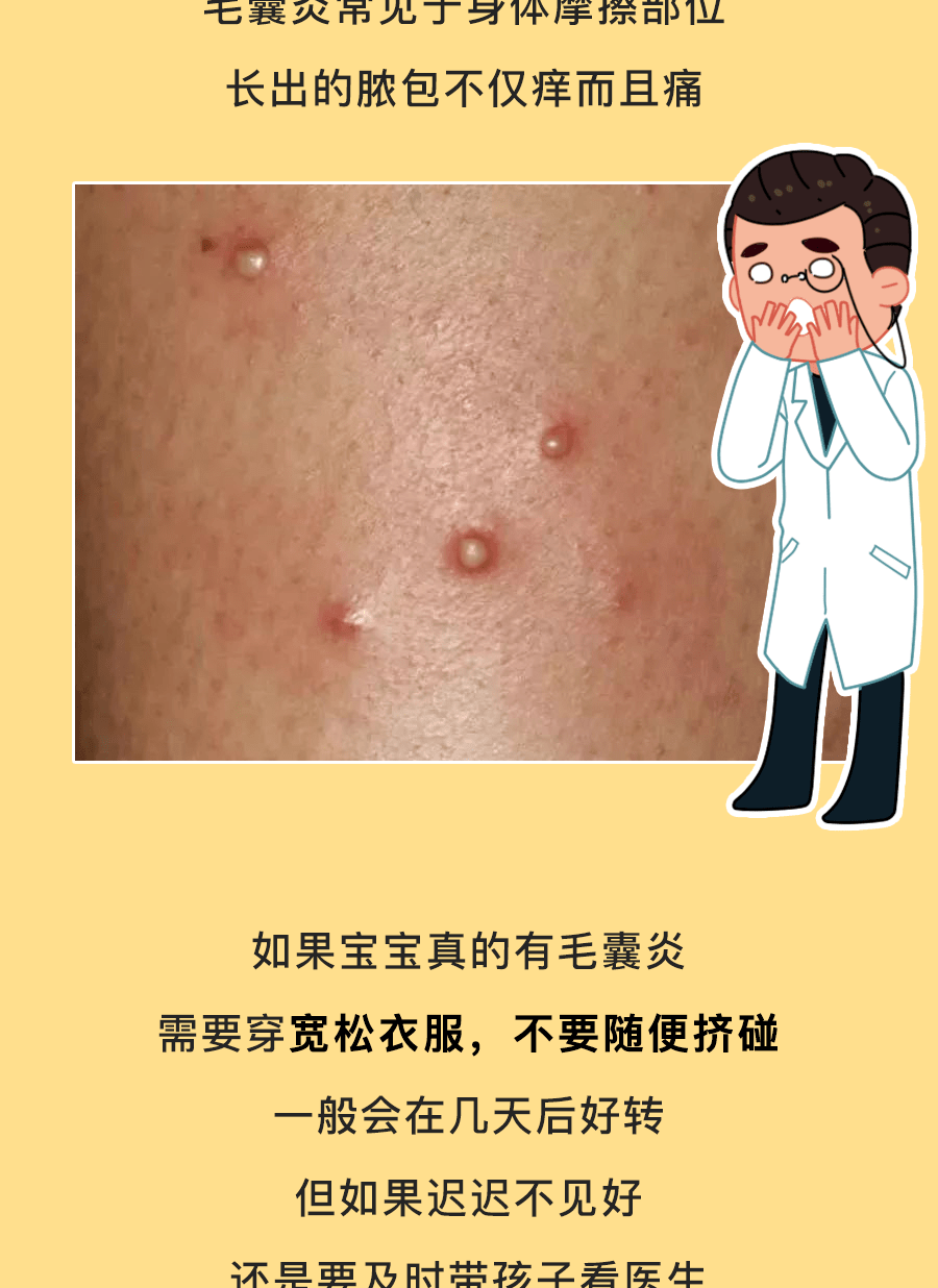 外阴长了一颗痘什么情况