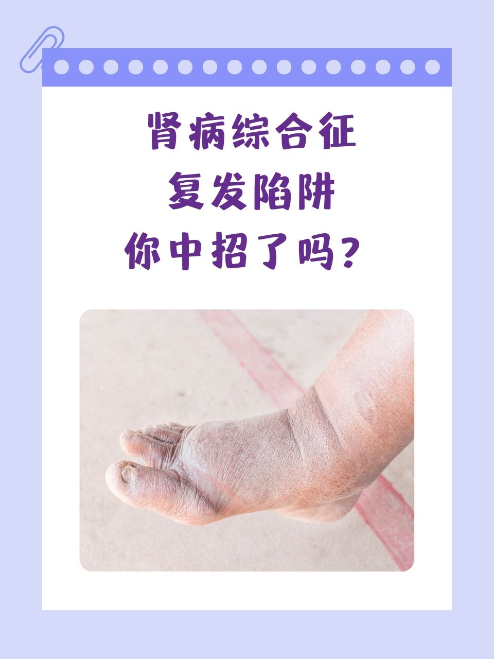 肾损伤有哪些症状表现