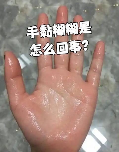手容易出汗该怎么办