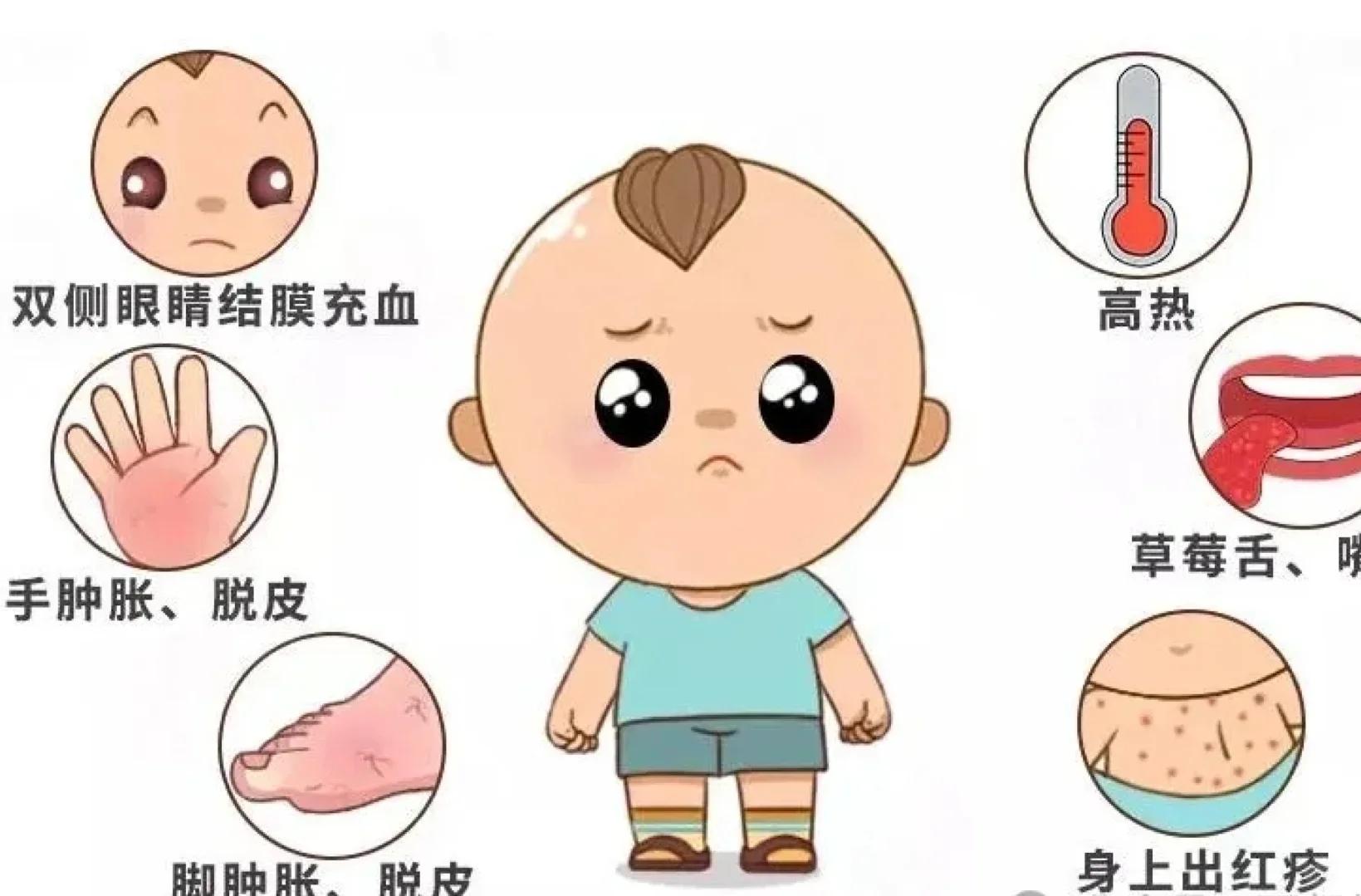 什么是川崎病?
