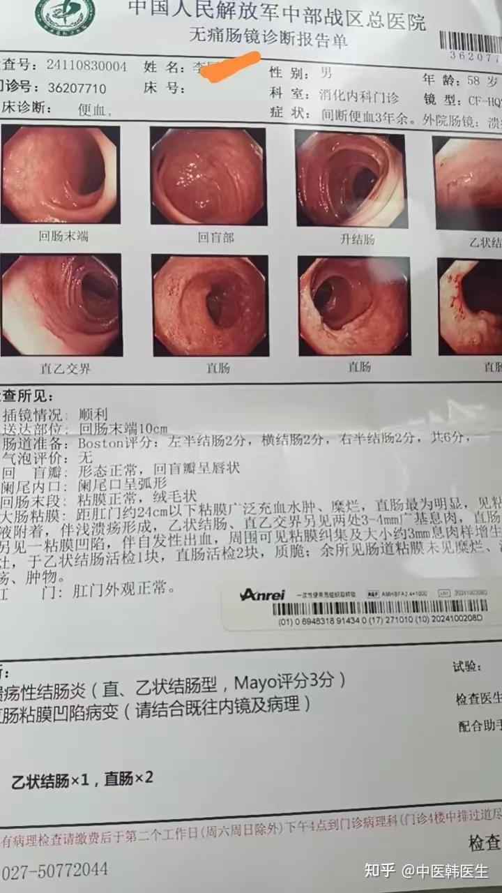 结肠炎的症状有哪些