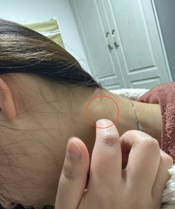 脖子里面有个疙瘩,什么导致的