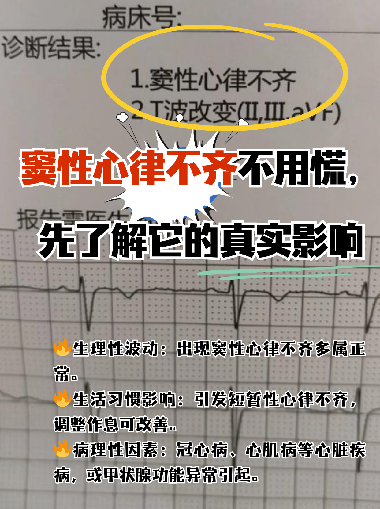 窦性心律不齐能跑步吗