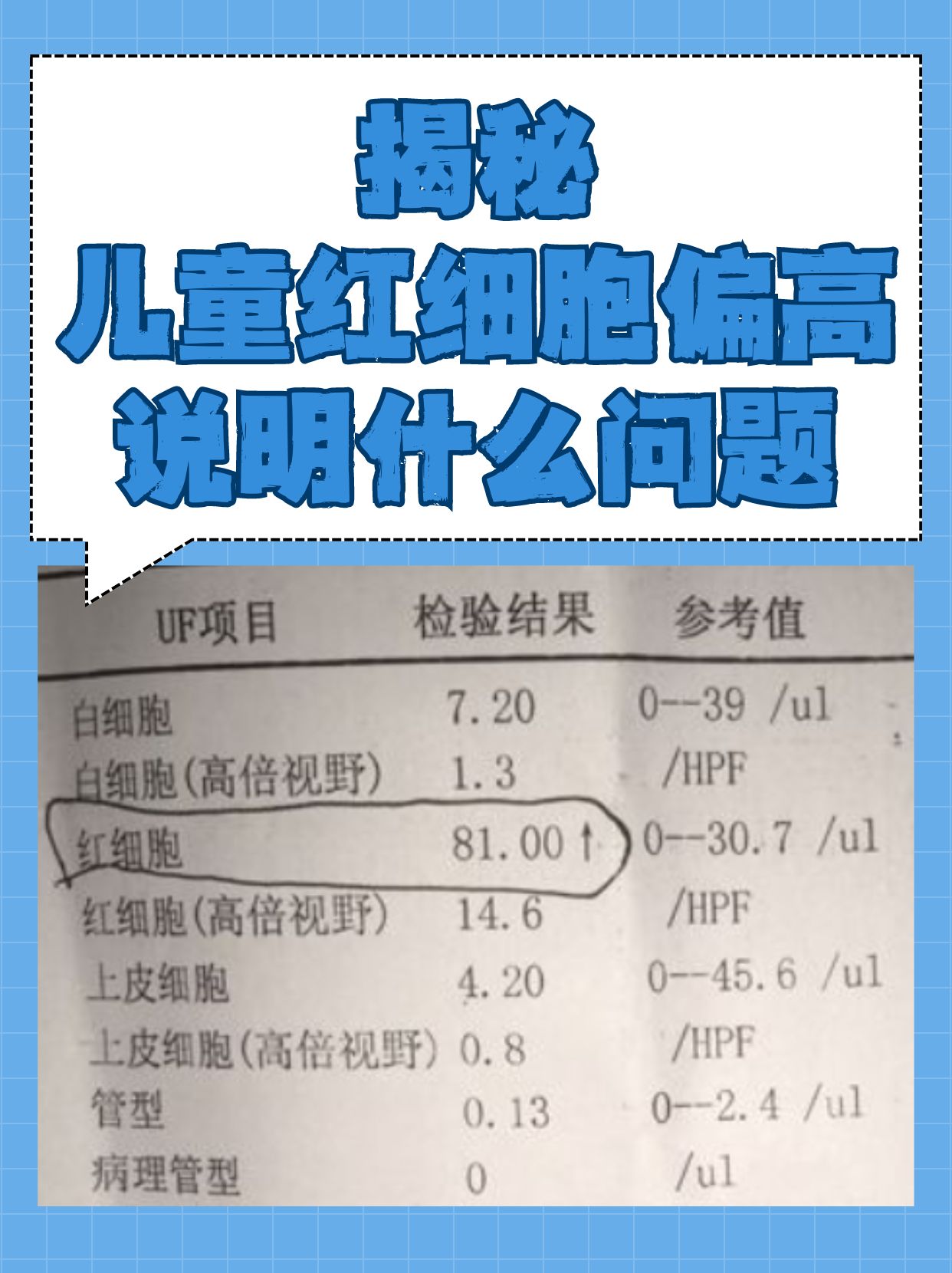 上皮细胞偏高是什么意思啊