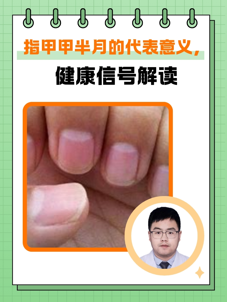 手指甲没有月牙是怎么回事