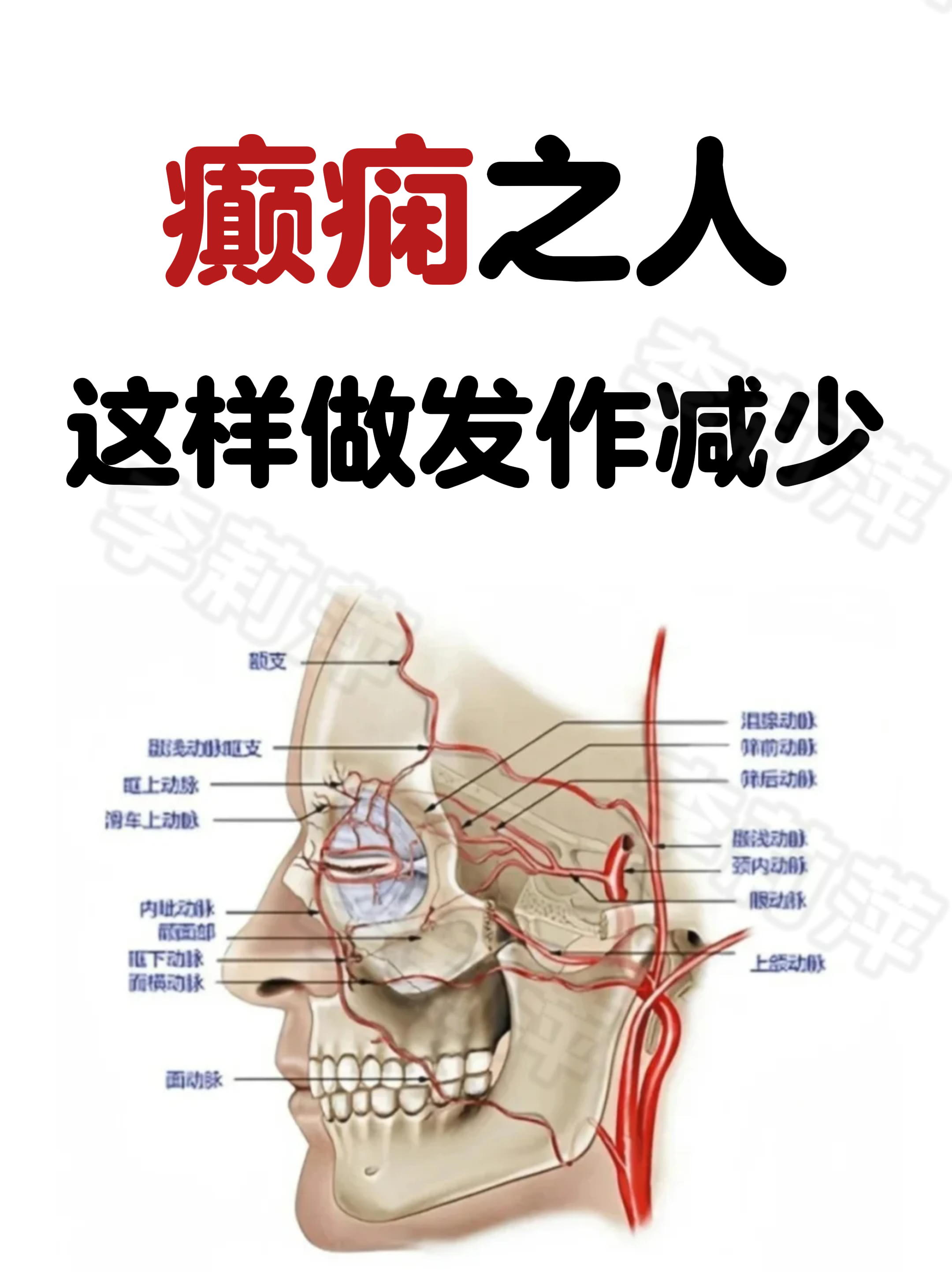 羊癫疯能治愈吗