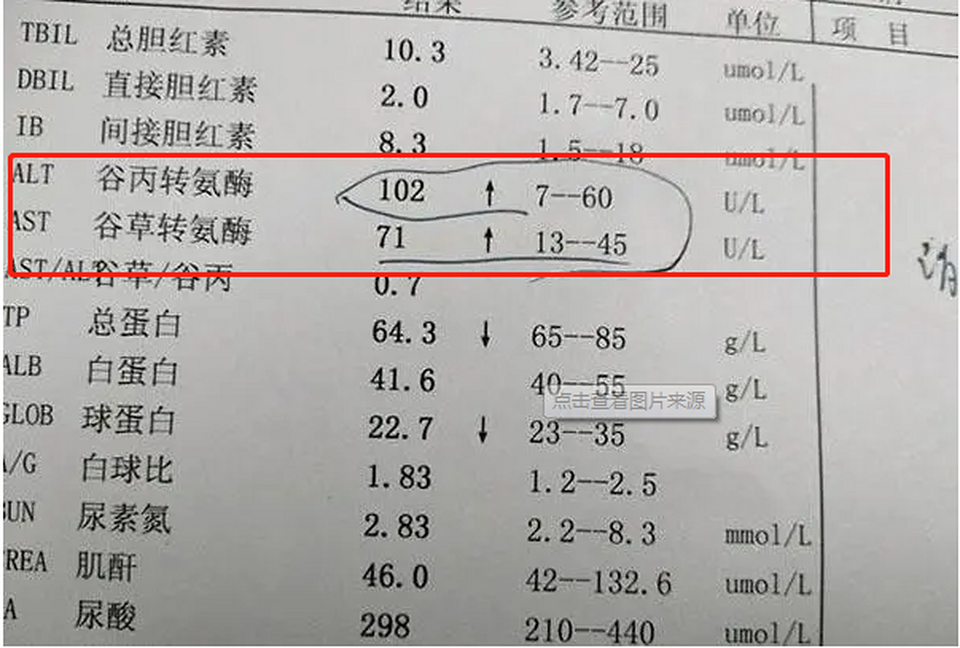 谷丙转氨酶偏低是什么原因