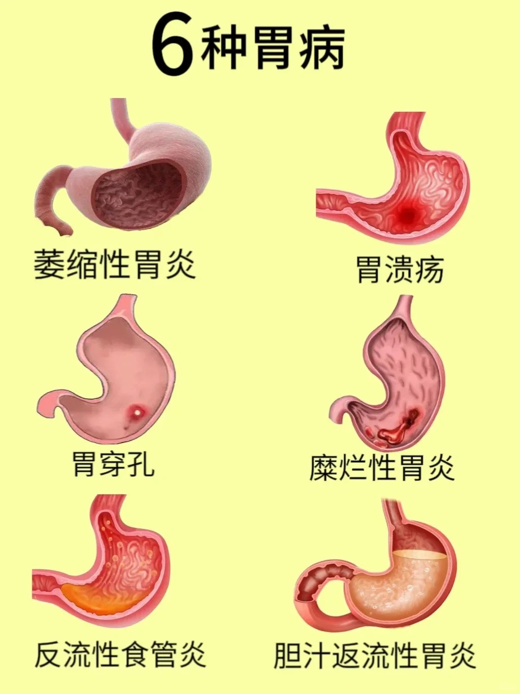 胃病看哪一科?
