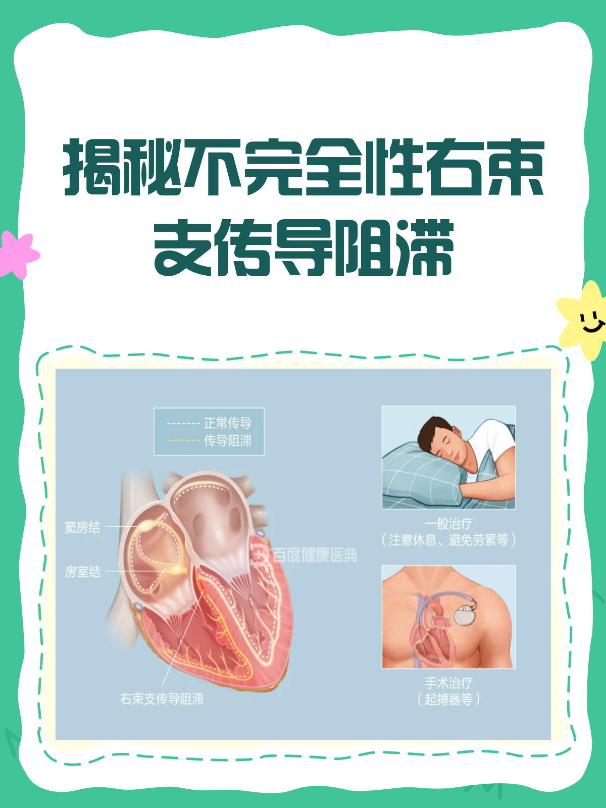 完全右传导阻滞能治好吗?.